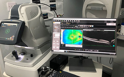 Free OCT Scan (Optical Coherence Tomography)